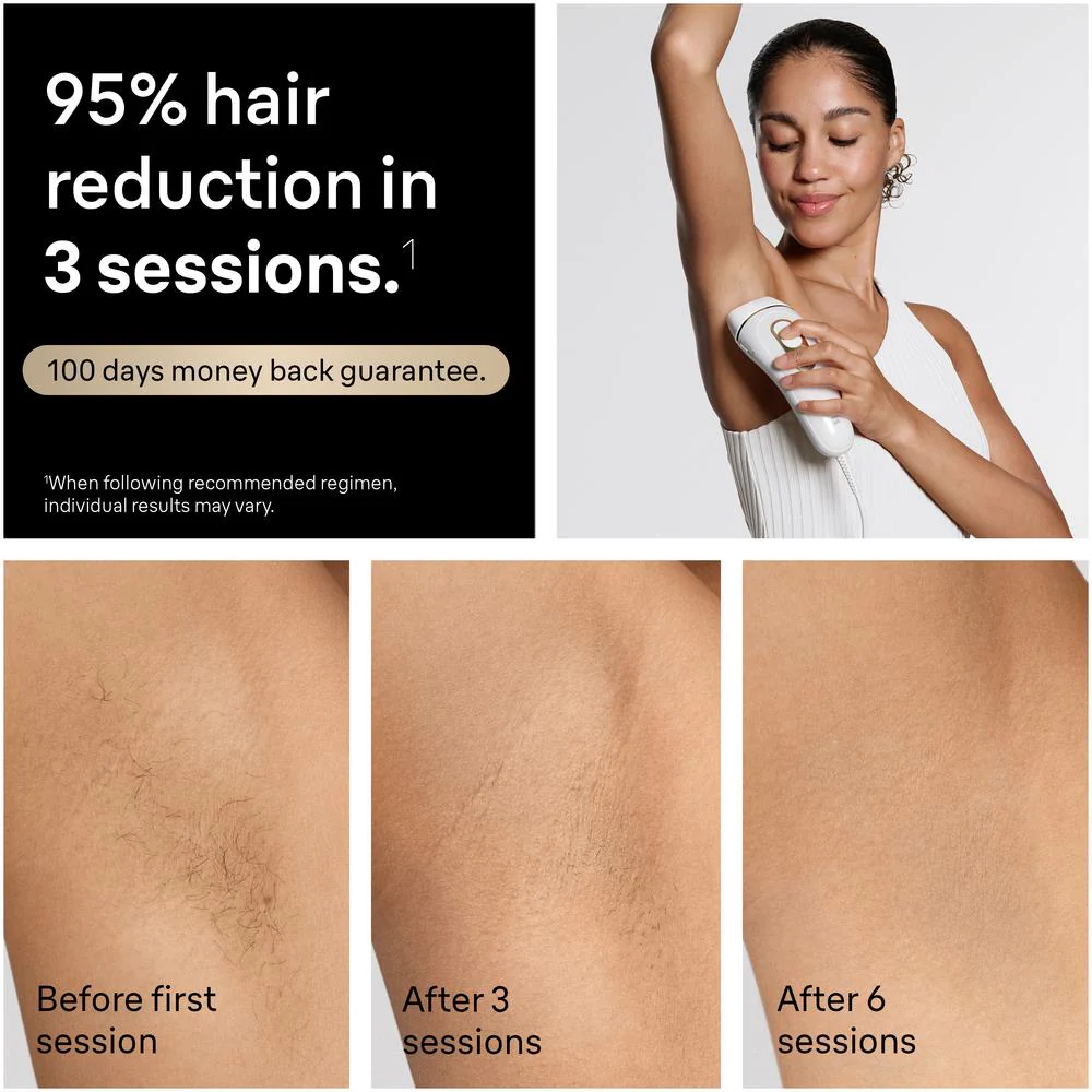 Braun IPL Silk-Expert Pro 5 Laser Hair Removal - Image 8