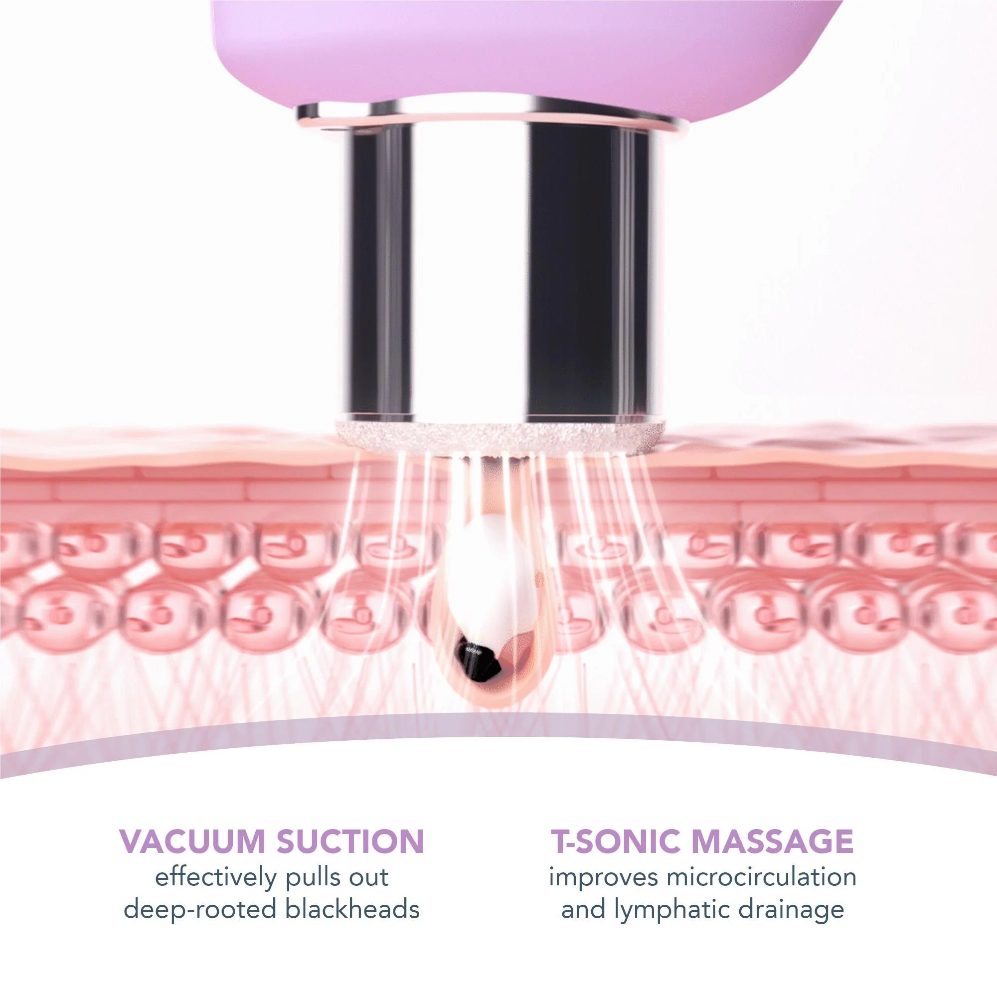 Foreo Kiwi Microdermabrasion (Lavendar) - Image 6