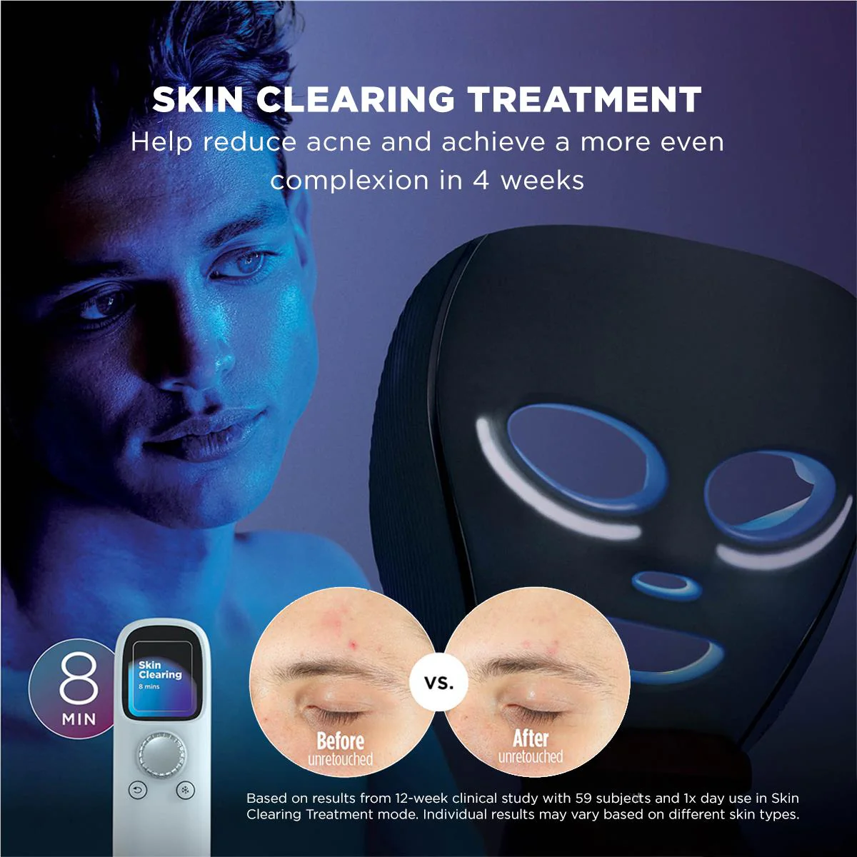 Shark™ CryoGlow™ Cooling + LED Face Mask (Lilac Chill) - Image 6