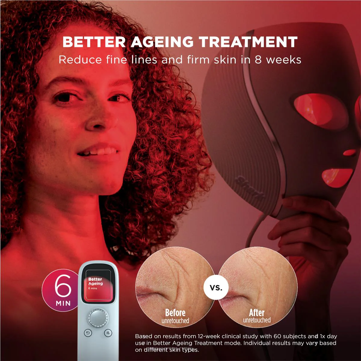 Shark™ CryoGlow™ Cooling + LED Face Mask (Lilac Chill) - Image 7